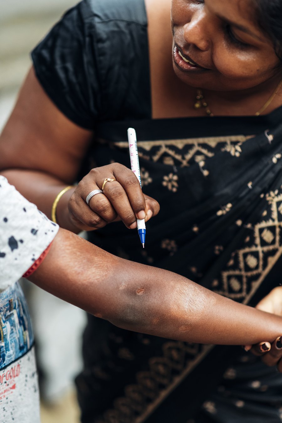 A skin patch on a young boy's arm