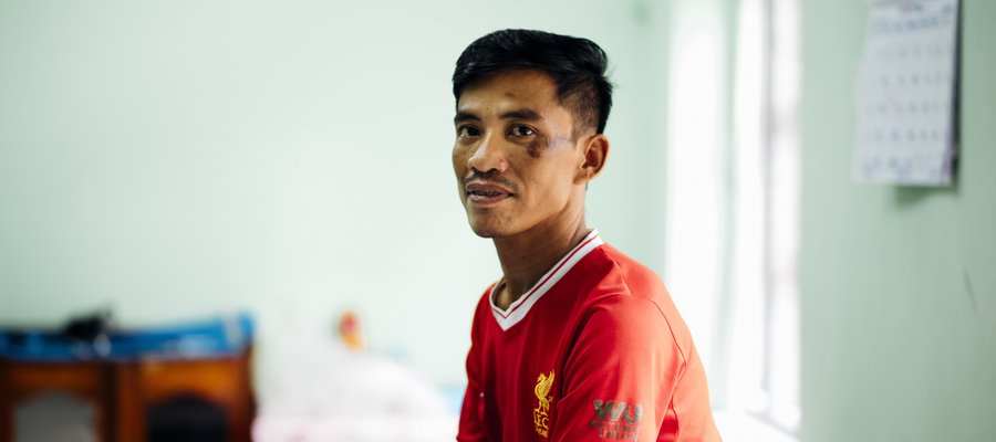 A man on a hospital bed in Myanmar looks to his left, at the photographer. He is proudly wearing a Liverpool FC top.