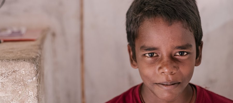 A young boy affected by leprosy looks at the camera