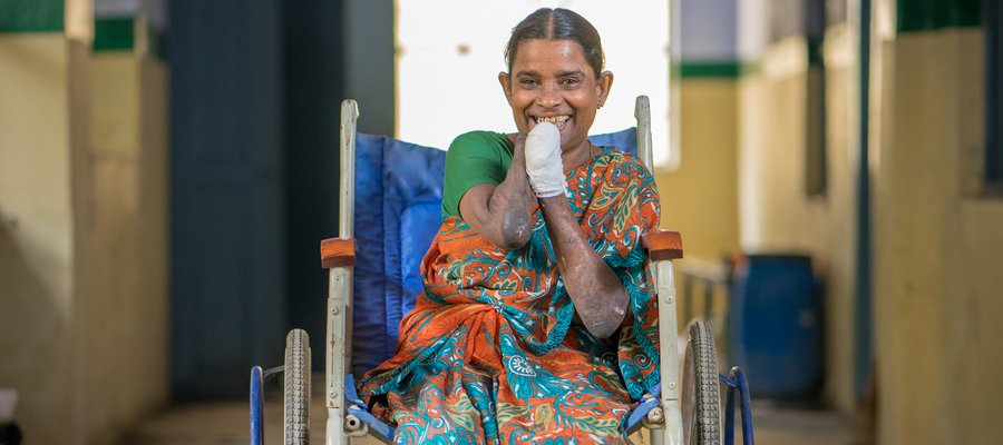 Nagammal smiles from her wheelchair in one of our hospitals
